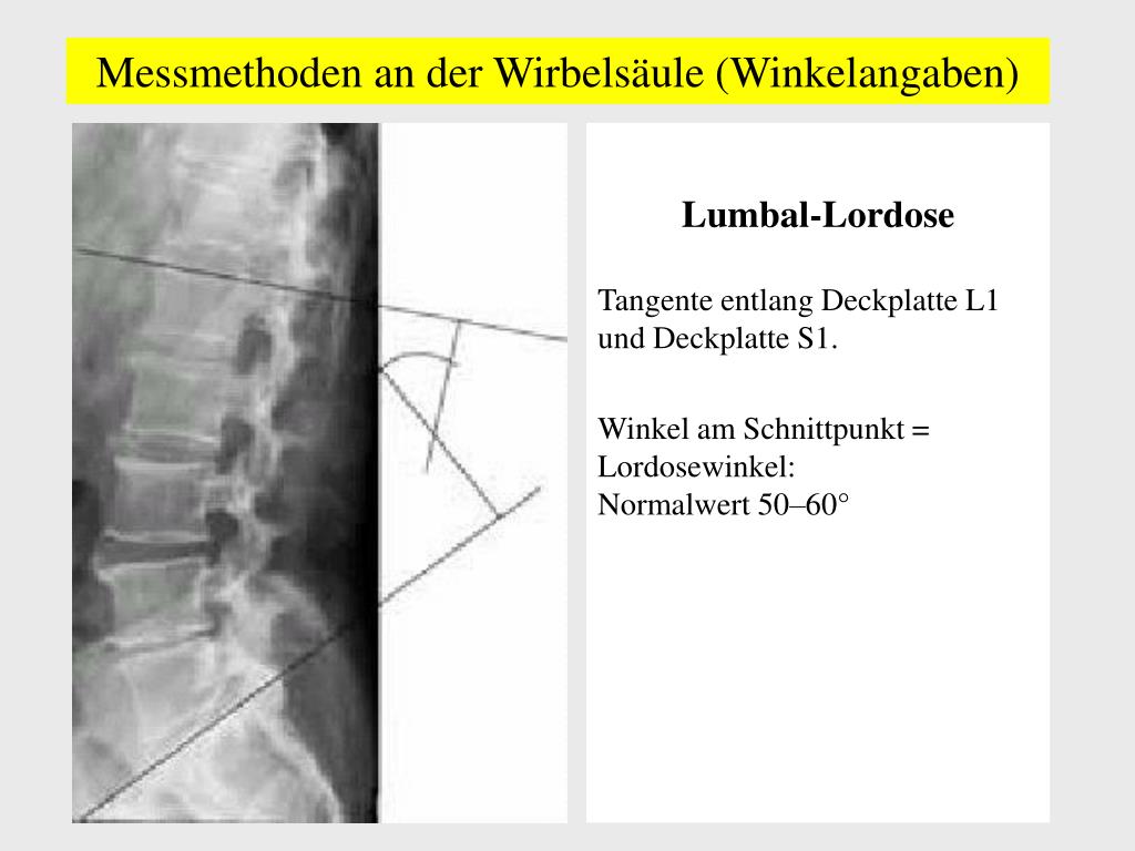 PPT - Referenzfilme zu Berufskrankheiten der Wirbelsäule PowerPoint