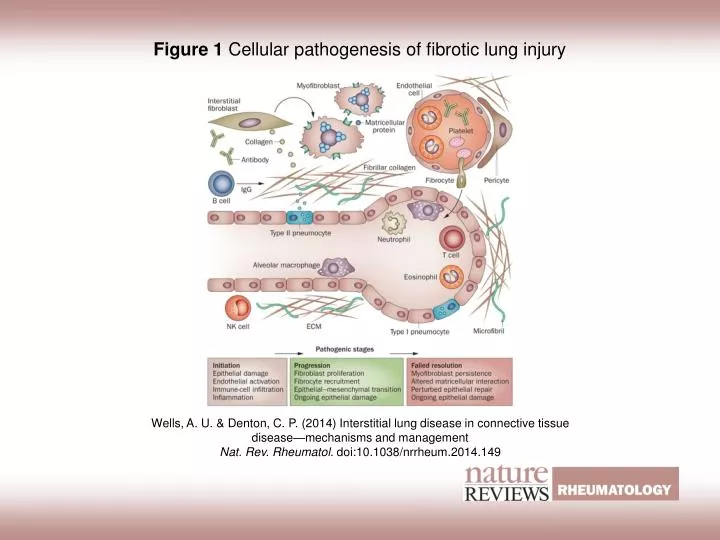 PPT - Figure 1 Cellular pathogenesis of fibrotic lung injury PowerPoint ...