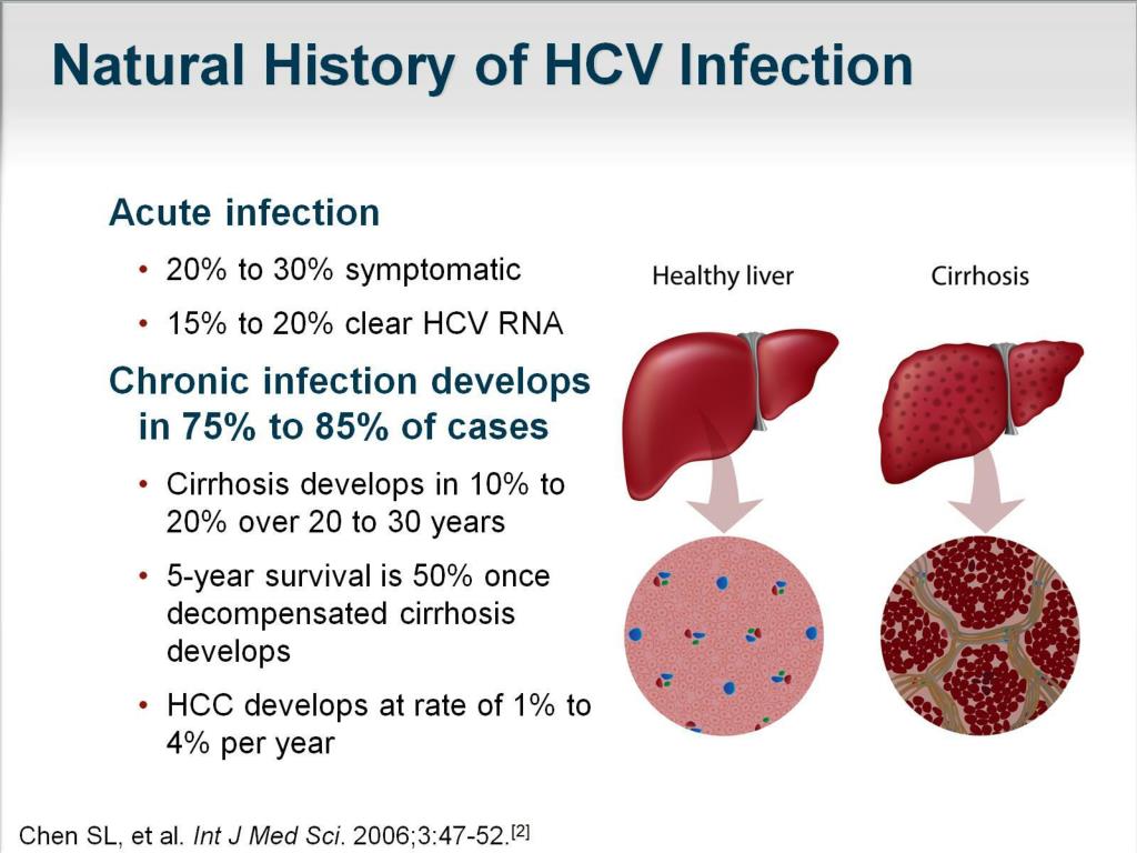 HCV. Hepatitis c virus 0,02 что это. How to limit Hepatitis. Гепатит ц через слизистые вероятность. Hcv инфекция