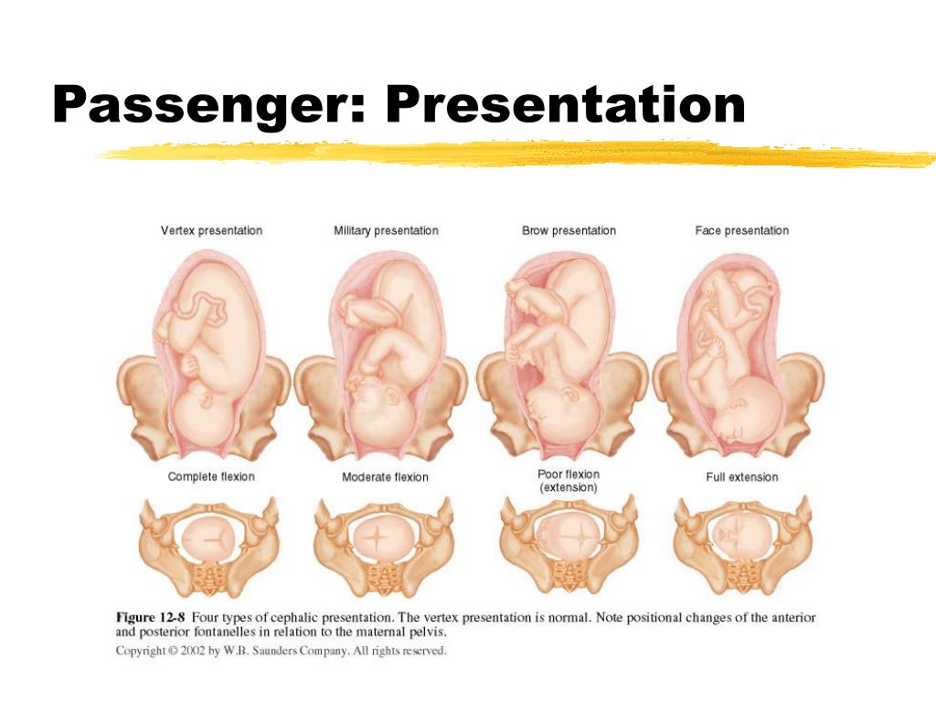 presentation during birth