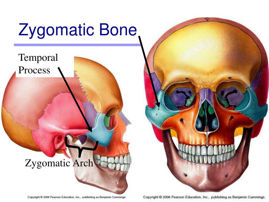 Анатомия скуловой кости. Zygomatic Bone. Zygomatic Bone Anatomy. Скуловые кости.