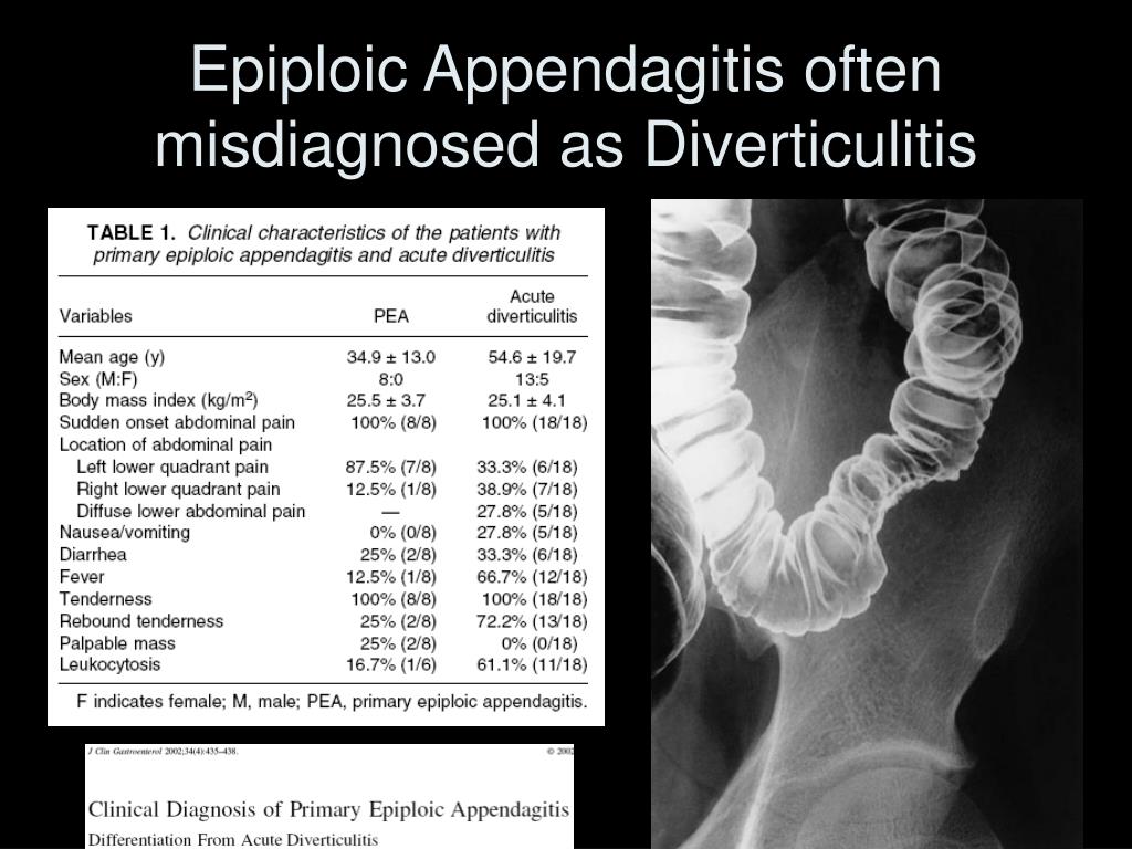 Apendagitis epiploica dieta