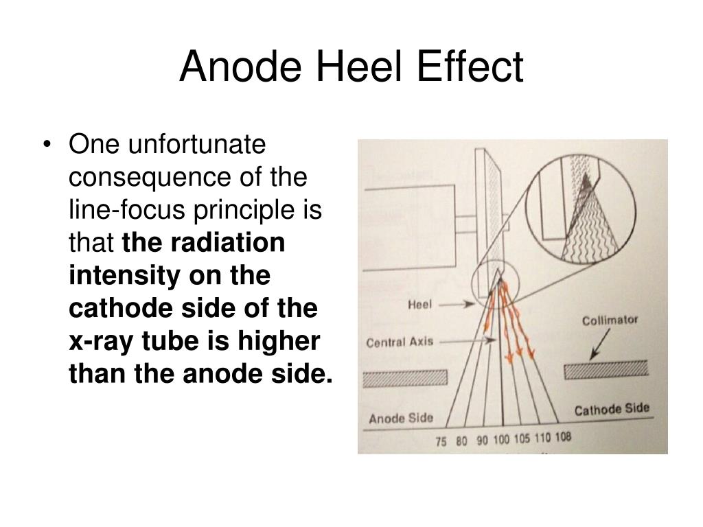 RADIATION PROTECTION IN DIAGNOSTIC AND INTERVENTIONAL RADIOLOGY - ppt video  online download