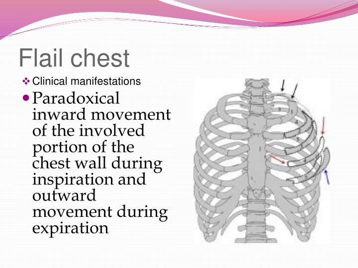 PPT - CARE OF PATIENT WITH CHEST INJURIES PowerPoint Presentation - ID ...
