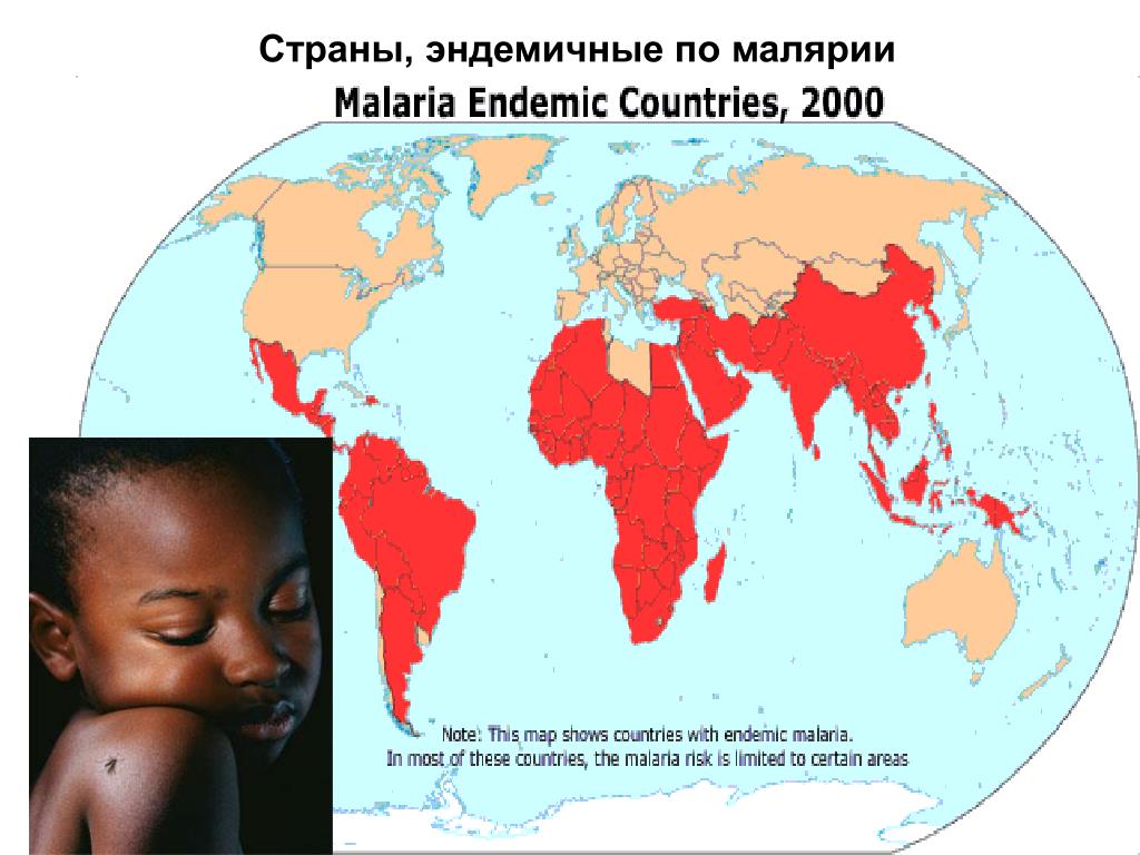 Какая малярия в африке. Страны эндемичные по малярии. Эндемичные районы по малярии. Распространение малярии. Карта распространения малярии.