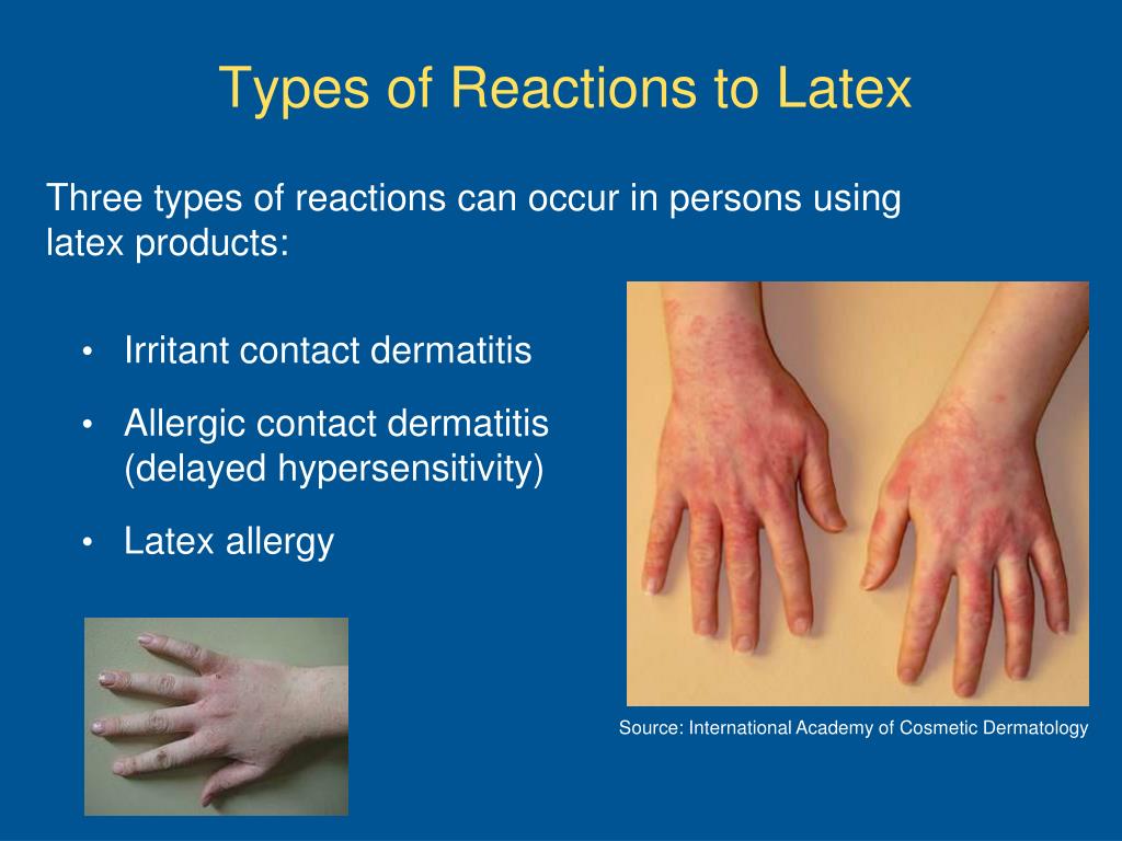 latex allergy cross reactivity