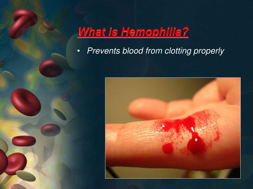presentation on hemophilia slideshare