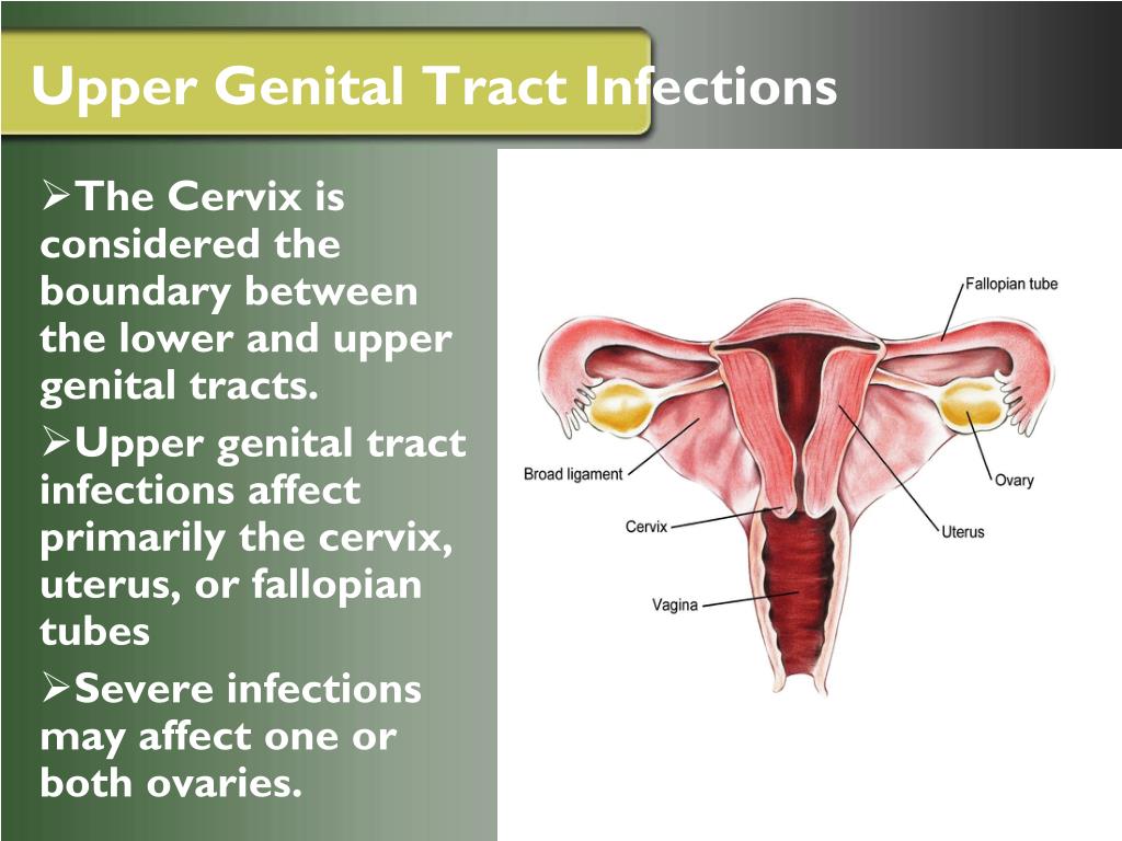 PPT Pelvic Inflammatory Disease PowerPoint Presentation Free 