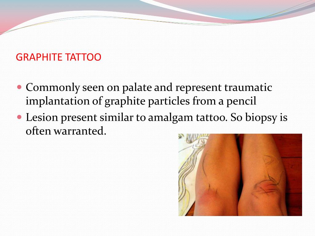 PPT - Depigmentation PowerPoint Presentation, free download - ID:6895954