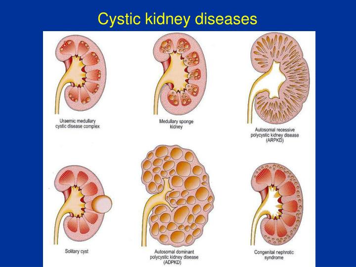 PPT PATHOLOGY OF KIDNEYS PowerPoint Presentation ID6902146