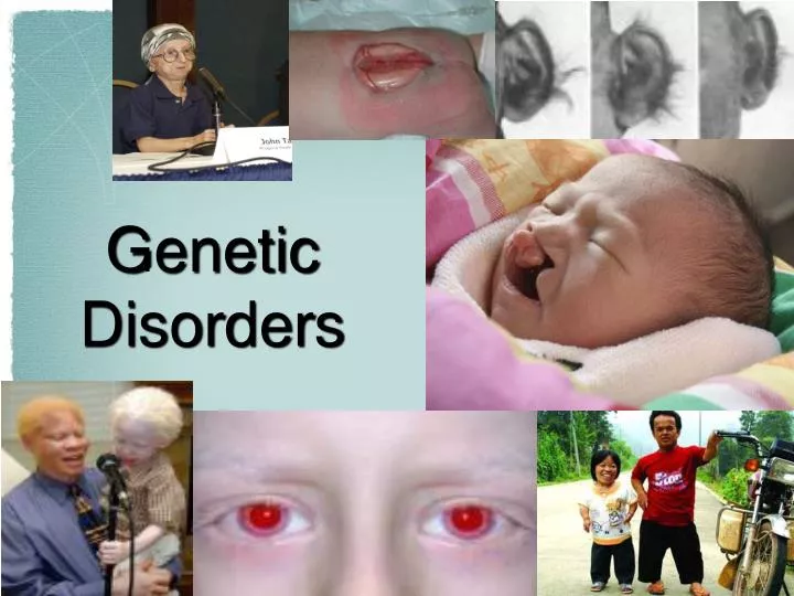 presentation of genetic diseases