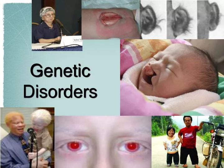 PPT Genetic Disorders PowerPoint Presentation Free Download ID 6904890