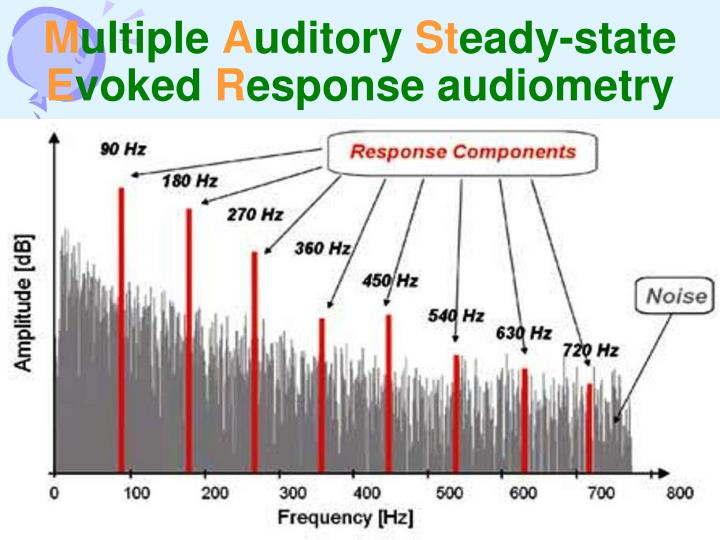 PPT - Audiometry PowerPoint Presentation - ID:6912897