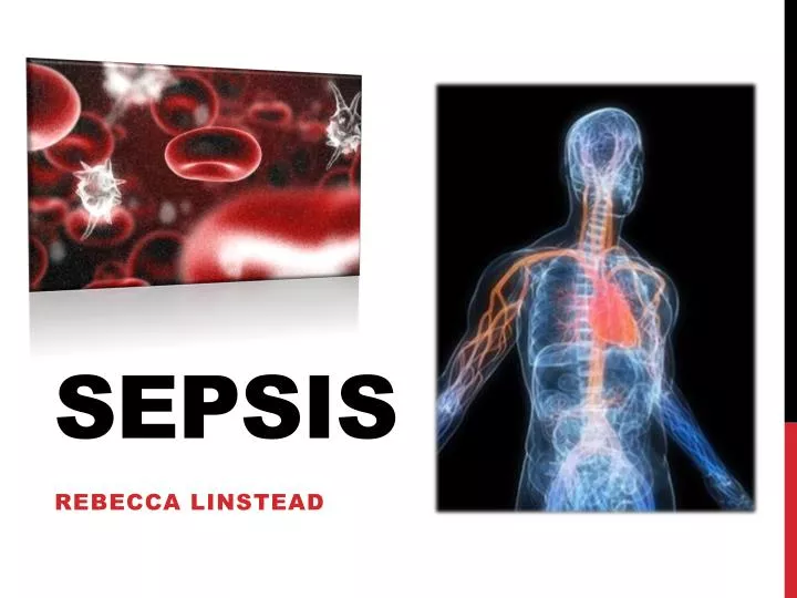 Ppt Sepsis Powerpoint Presentation Free Download Id6920054