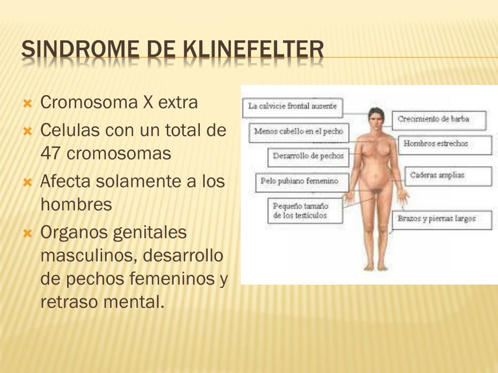 Características Da Síndrome De Klinefelter Sololearn