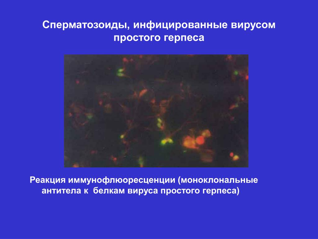 Реакция иммунофлюоресценции презентация