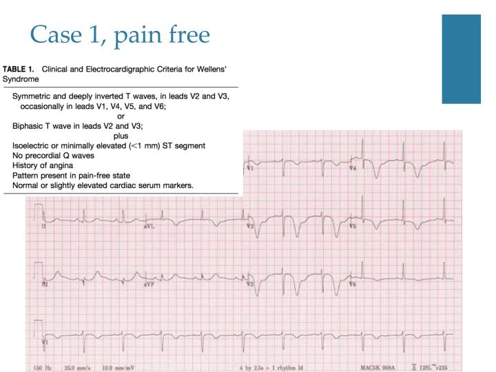 PPT - Wellens ’ Syndrome PowerPoint Presentation - ID:6938565