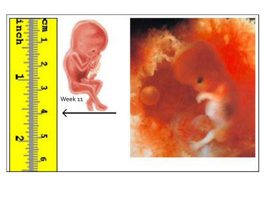 Сколько будет 11 недель. Эмбрион на 11 неделе беременности фото. 12 Недель беременности размер плода. Размер ребенка на 12 неделе.