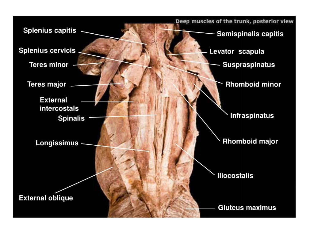 Ppt Splenius Capitis Powerpoint Presentation Free Download Id 6949075