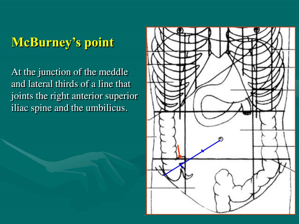 PPT Part II Splanchnology Chapter 4 The General Description PPT Part II Splanchnology Chapter 4 The General Description