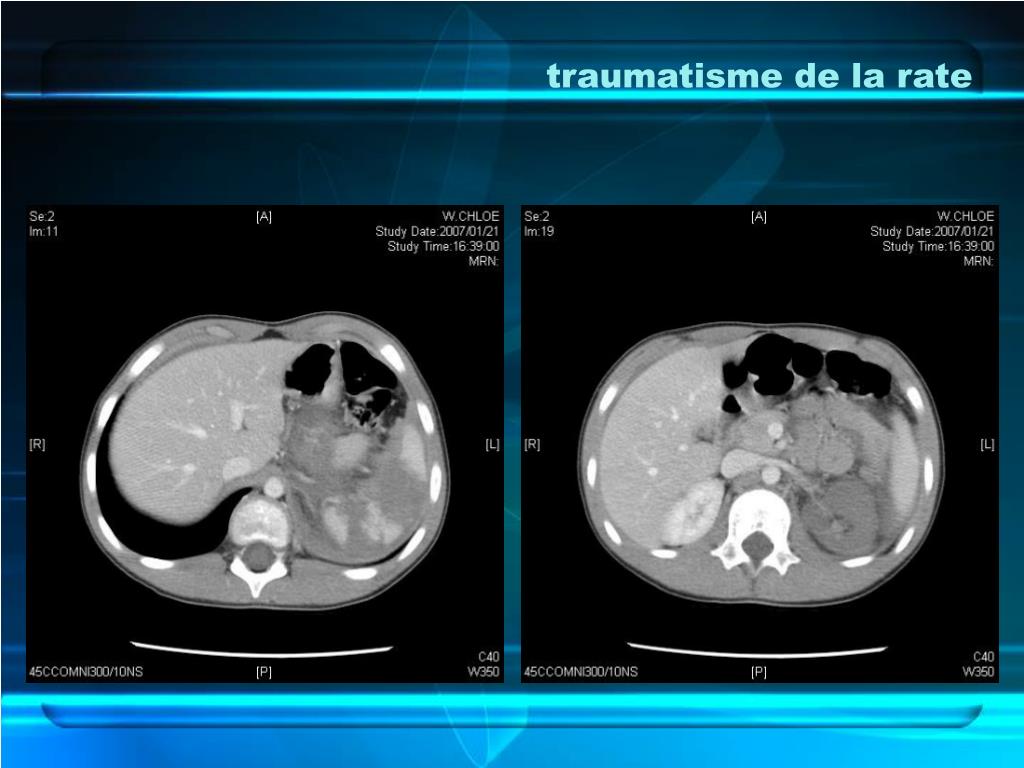 PPT CHIRURGIE PEDIATRIQUE PowerPoint Presentation, free download ID — free download