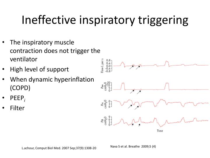 PPT Patient Ventilator Asynchrony in Non invasive Ventilation and