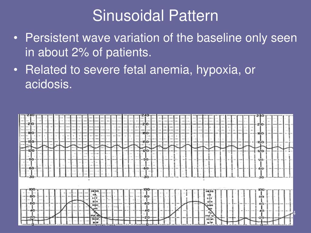 PPT Basic Fetal Monitoring Review PowerPoint Presentation, free