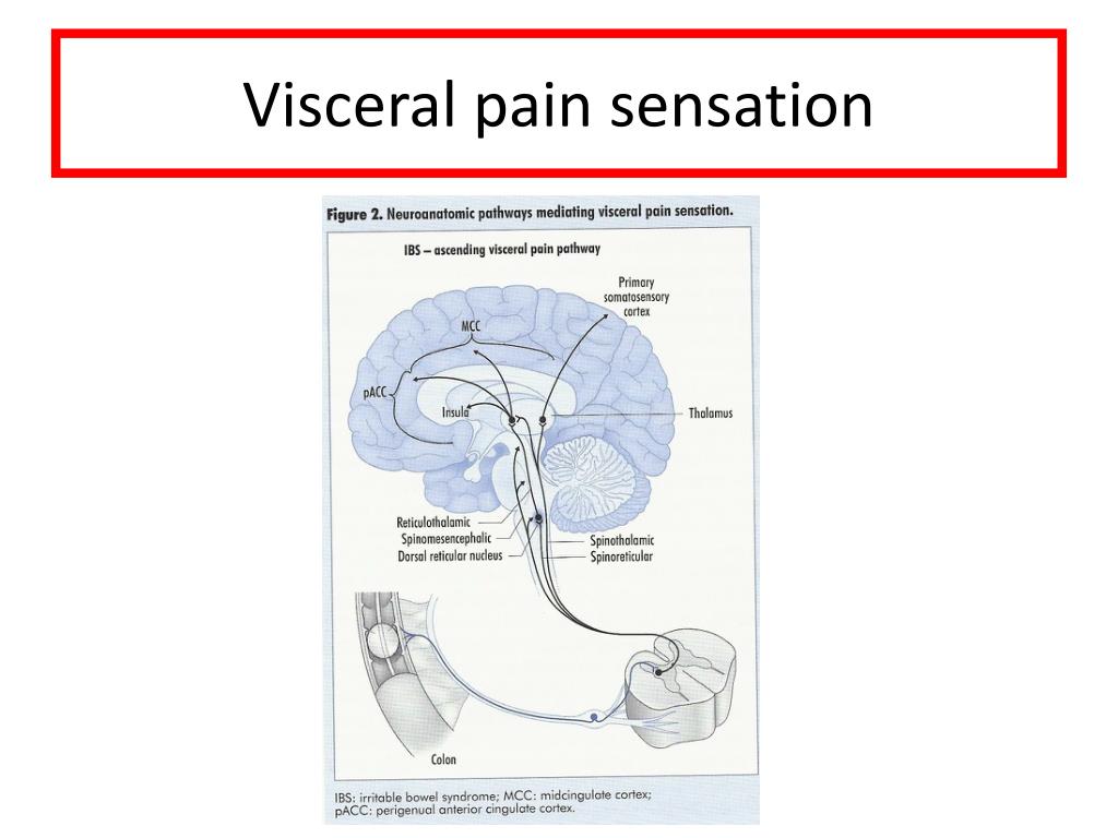 PPT - Irritable Bowel Syndrome PowerPoint Presentation, free download ...