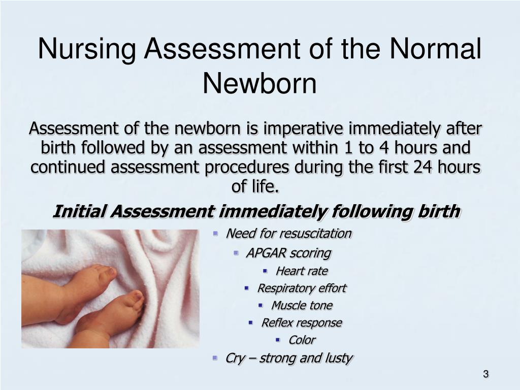 newborn presentation