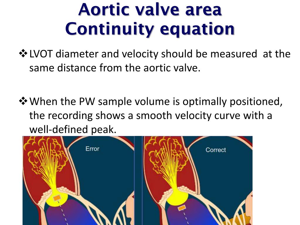 Ppt Echocardiographic Assessment Of Aortic Valve Stenosis Powerpoint