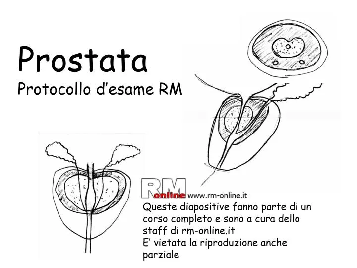 prostata protocollo d esame rm n.
