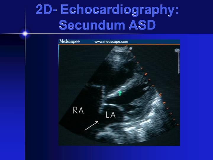PPT - Atrial Septal Defects PowerPoint Presentation - ID:6991552