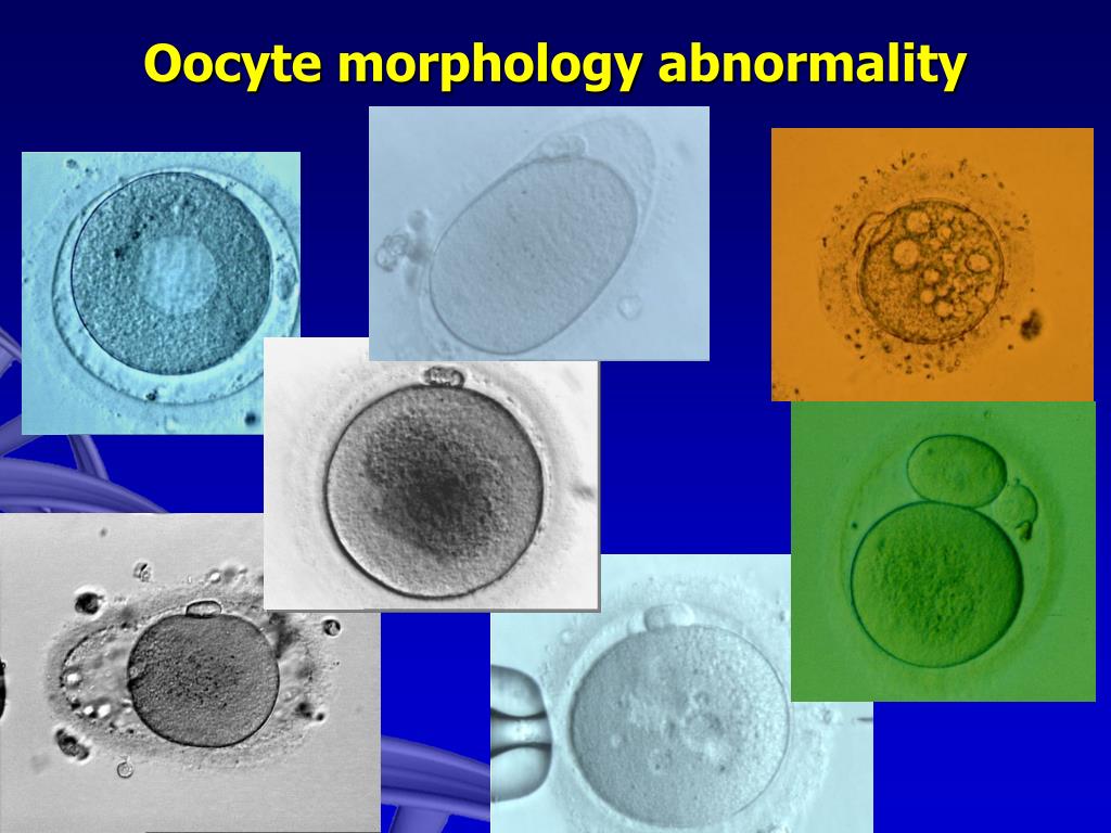 IVF.net - Oocyte with Large Polar Body • Amazing IVF Photos