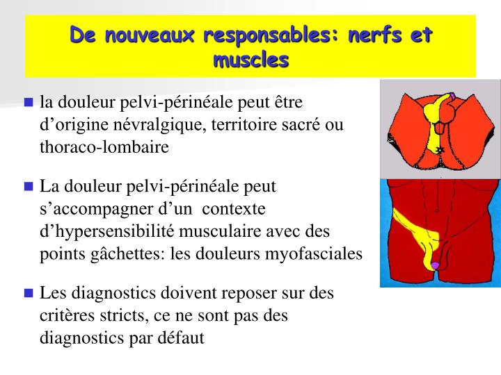 Inconvénients Du Stimulateur Du Nerf Sacré Vessie