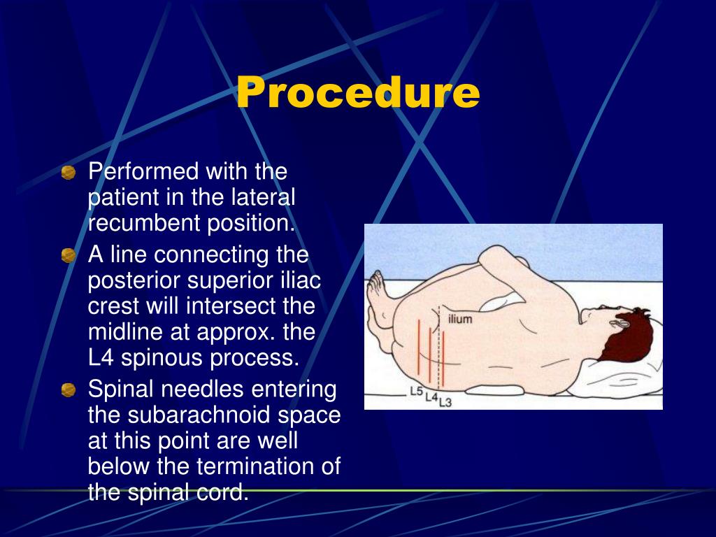 Ppt common diagnostic procedures in pediatrics powerpoint