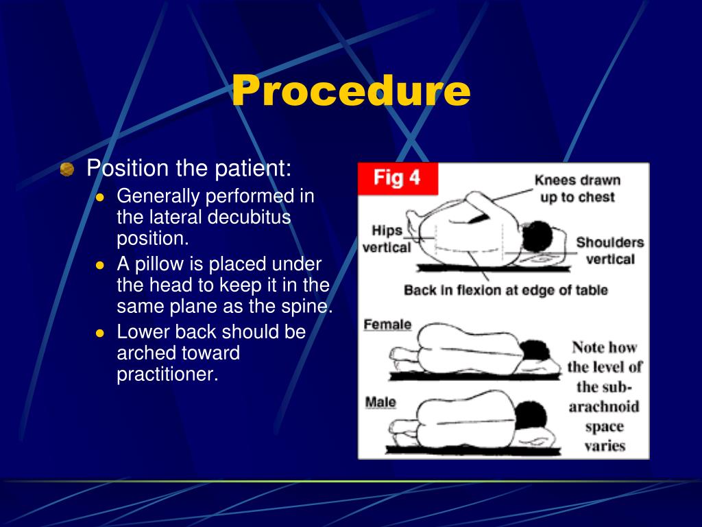 Common Diagnostic Procedures