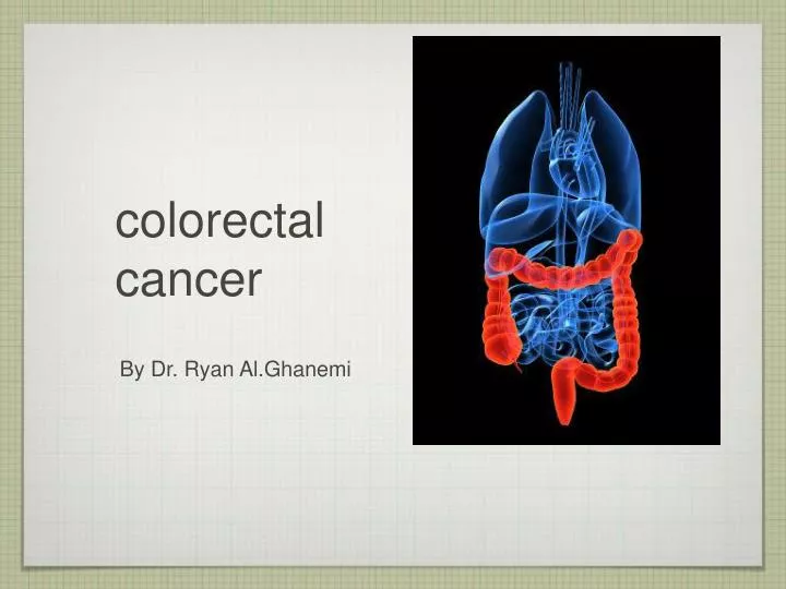Ppt Colorectal Cancer Powerpoint Presentation Free Download Id7001891