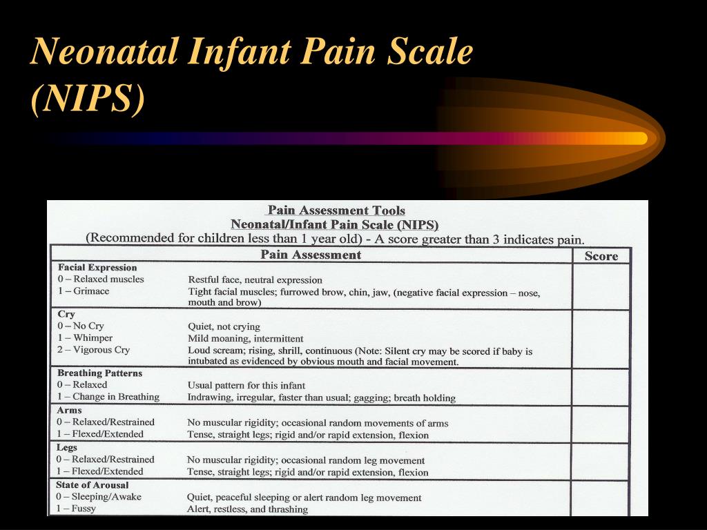 PPT Neonatal Pain PowerPoint Presentation, free download ID7003993
