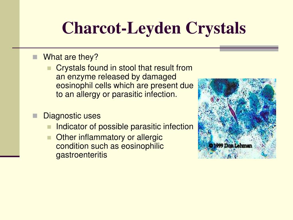 PPT - DIARRHEA PowerPoint Presentation, free download - ID ...