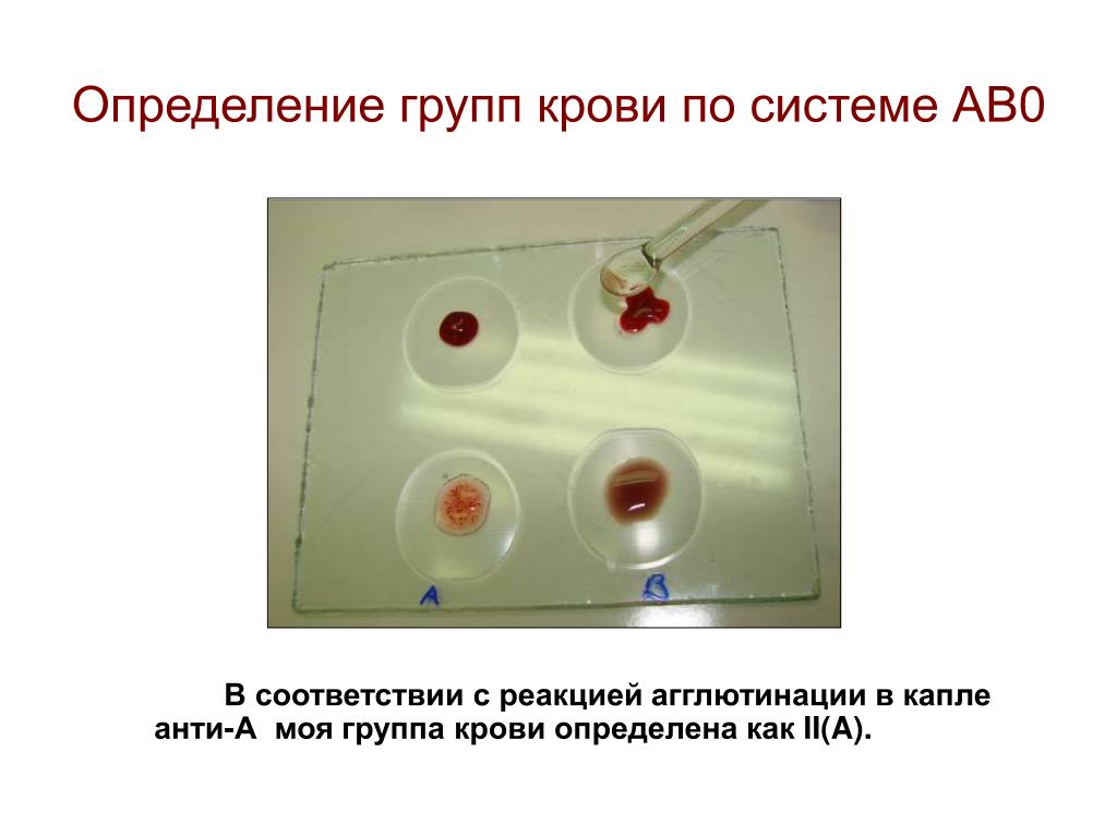 Определить группу крови тест. Агглютинация по группам крови. Определение группы крови. Реакция определения группы крови. Методика определения группы крови.