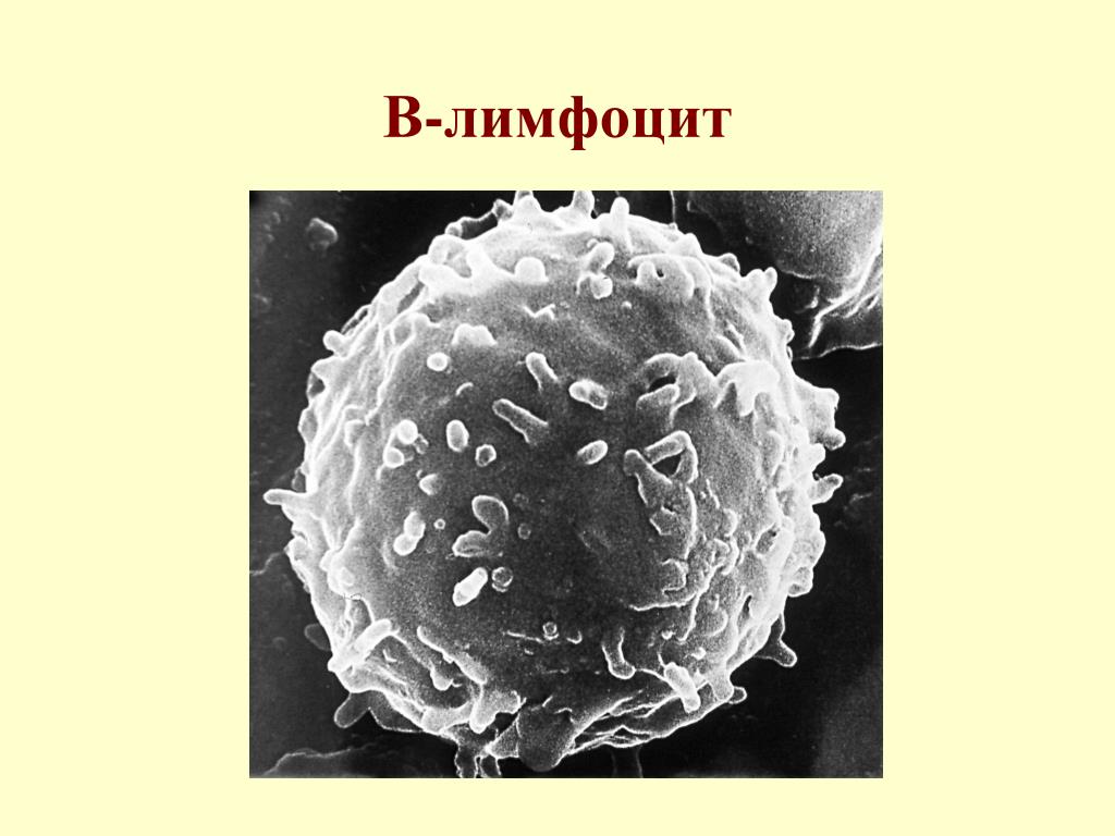 Лимфоциты какой иммунитет. Б-лимфоциты иммунной системы. B-клетки в b лимфоциты. Т-лимфоциты и в-лимфоциты. Т лимфоциты под микроскопом.
