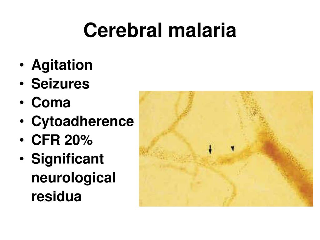 PPT - Malaria PowerPoint Presentation, Free Download - ID:7028072