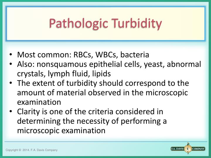 PPT PHYSICAL EXAMINATION OF URINE PowerPoint Presentation ID7036624