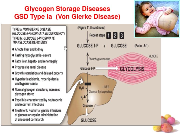 PPT Glycogen Metabolism PowerPoint Presentation ID7039540