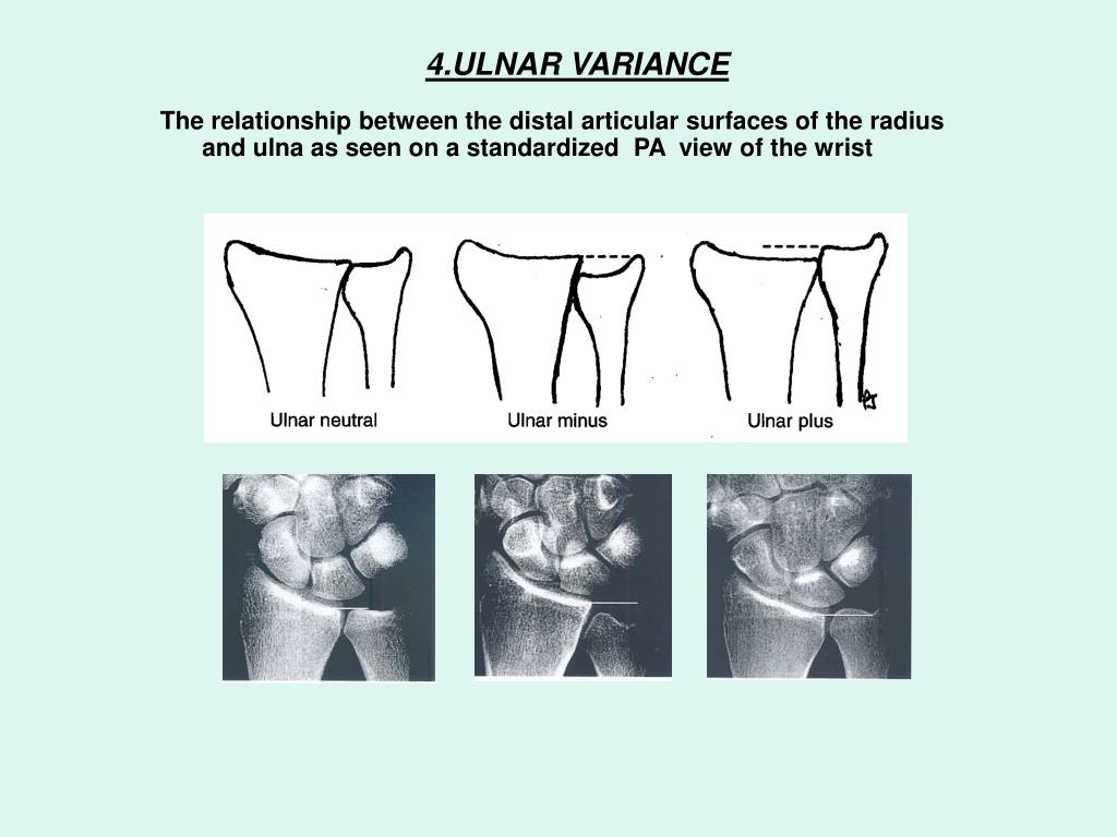 PPT Igo Goldberg M D Hand Surgeon Tel Aviv Israel PowerPoint 