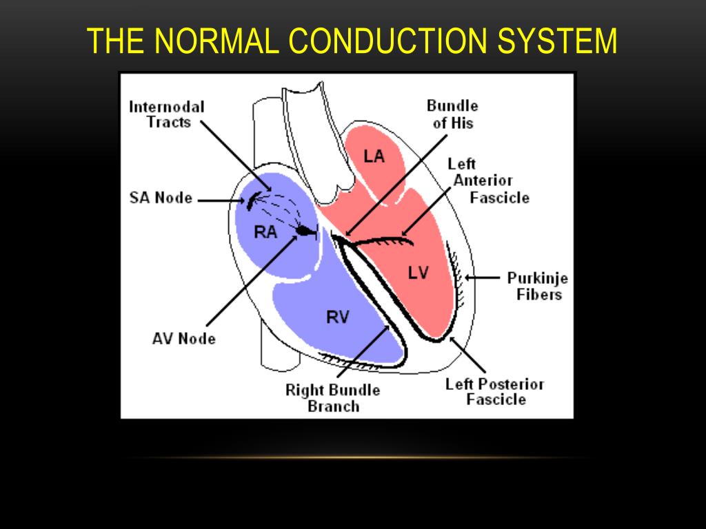PPT ECG Basics PowerPoint Presentation Free Download ID 7056722