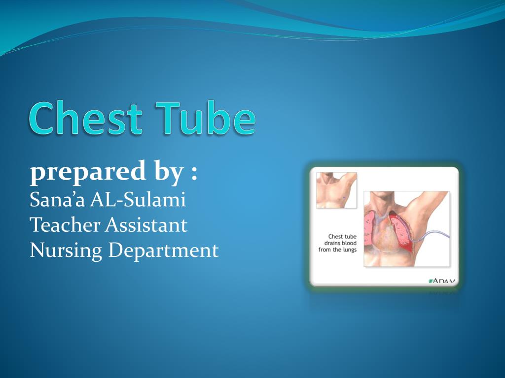 Chest tube insertion: Uses, procedure, and recovery