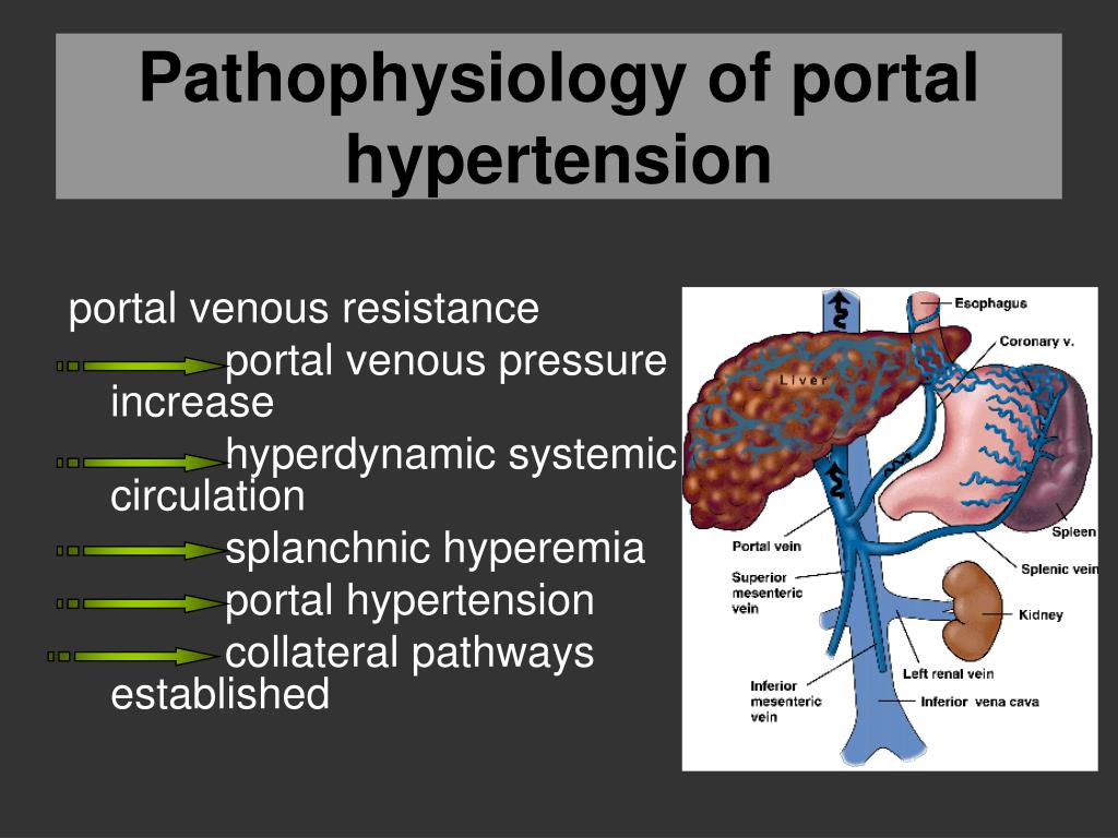 most common presentation of portal hypertension