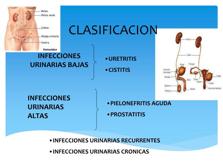 PPT - Infección Tracto Urinario PowerPoint Presentation - ID:7072373