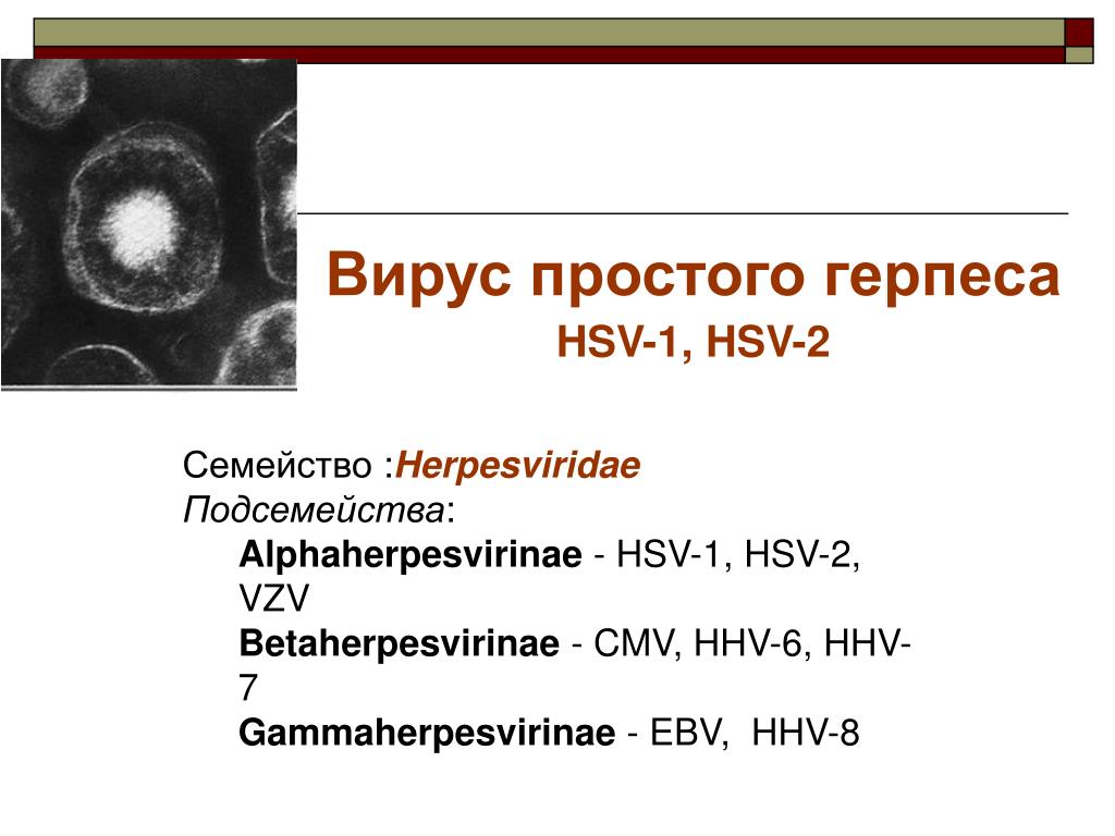 PPT - Herpes Simplex Virus (HSV) PowerPoint Presentation, free download - ID:2334949